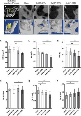 Effect of the Number of Micro-Osteoperforations on the Rate of Tooth Movement and Periodontal Response in Mice